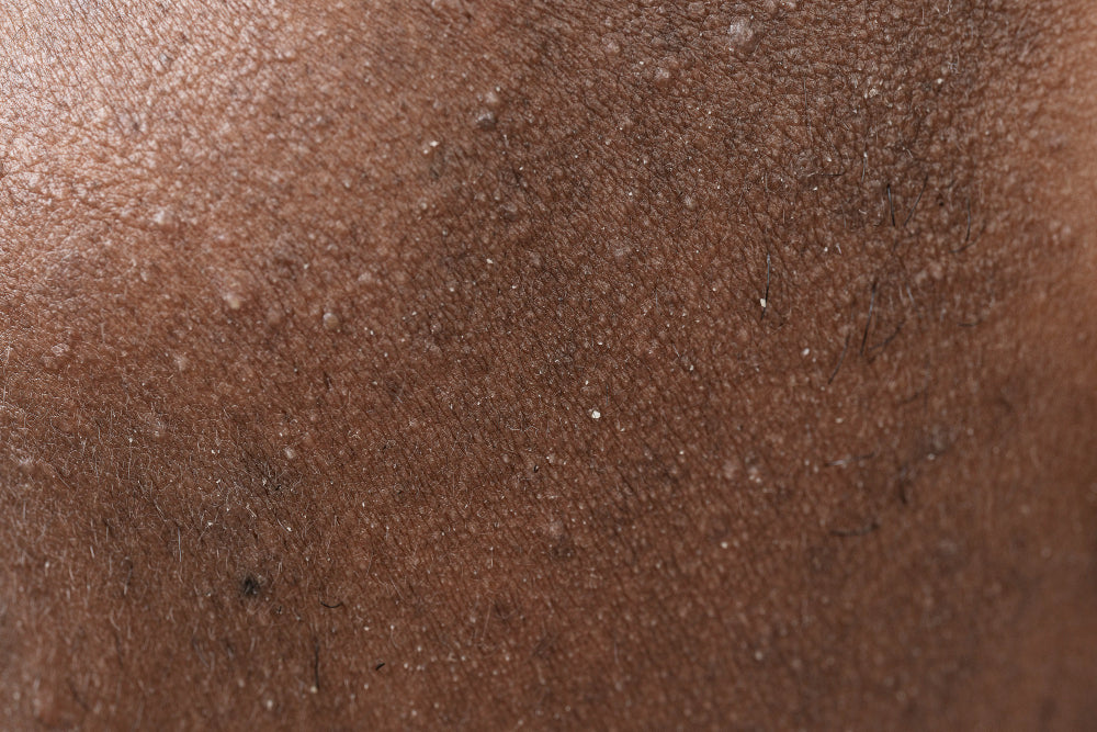 A Complete Guide to Effective Treatment and Skincare S – MYXCAPE A Complete Guide to Effective Treatment and Skincare S – MYXCAPE