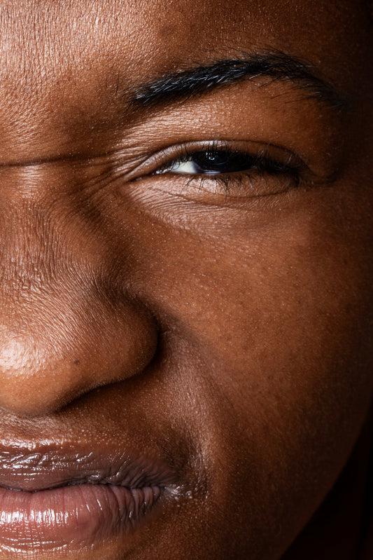 Skin Elasticity: Your Guide to Stronger, Tighter, Healthier Black Skin - close up