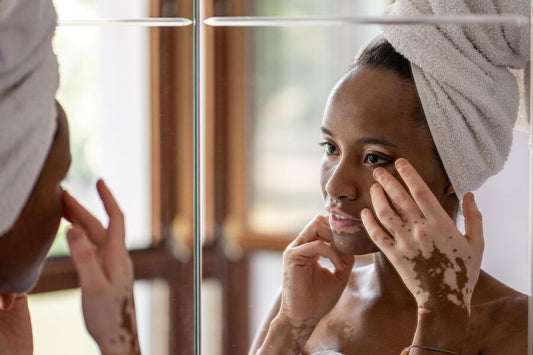 Young african brazilian woman with Hypopigmentation (vitiligo) with towel lookint at mirror her face and hands skin care and genetic