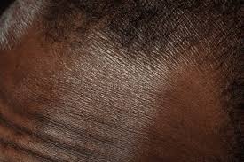 Why Your Skin Reacts When You Change Climates and How to Care for It P – MYXCAPE