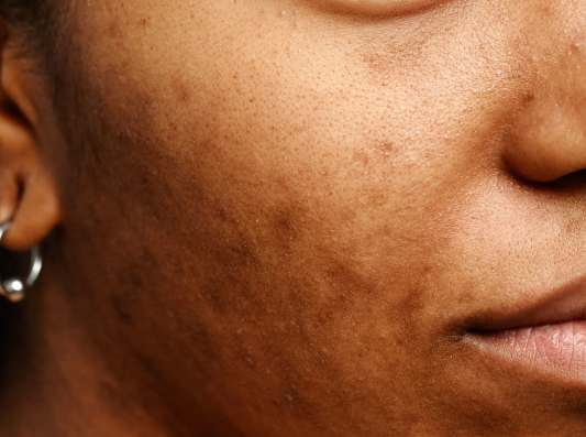 The First Week of the Year: Why Resetting Your Skin Is Just as Important as Resetting Your Goals?