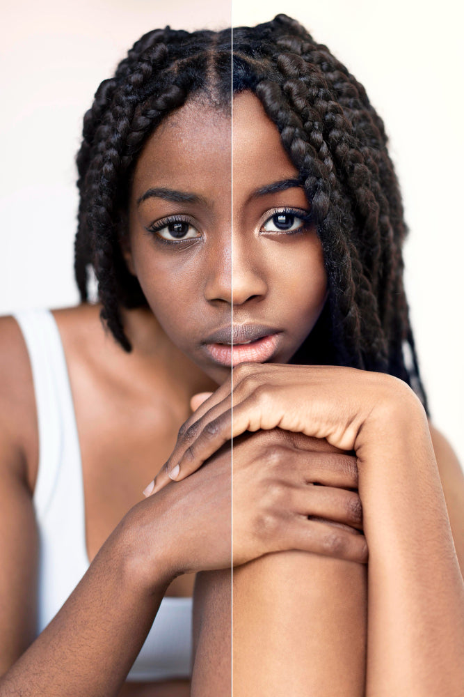Skin Regeneration for Black and Brown Skin-Woman