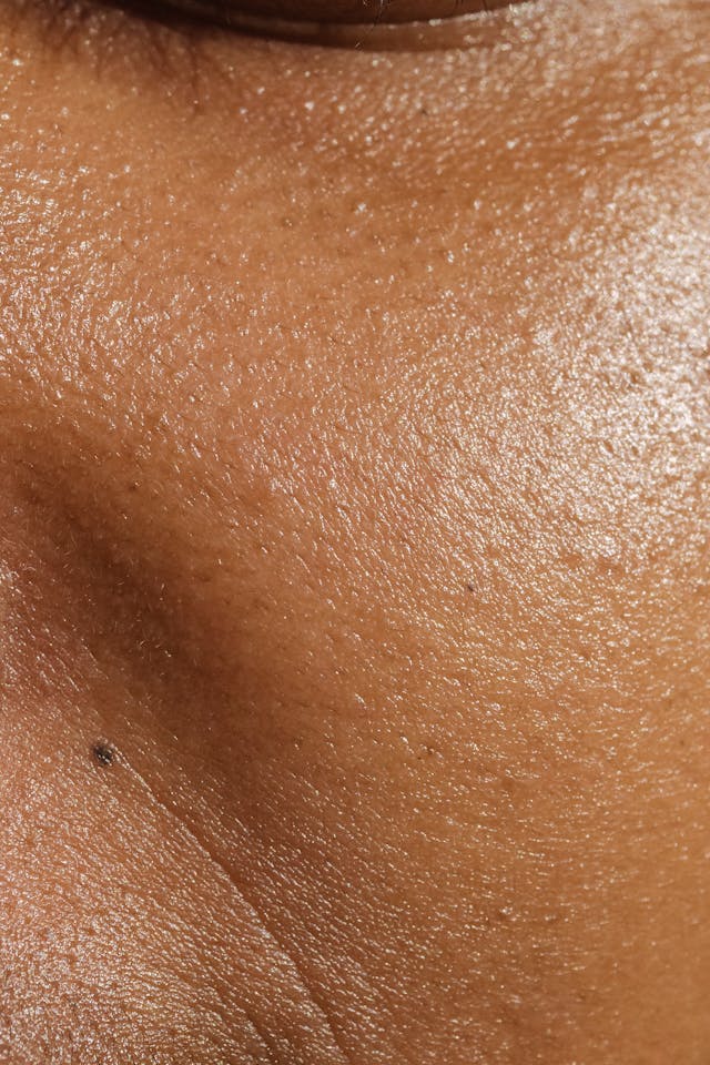 Clogged Pores and How to Avoid It